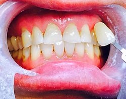 Natick Family Dental Natick Family Dental